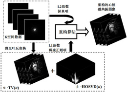 一种基于张量分解稀疏约束的三维心脏磁共振成像方法
